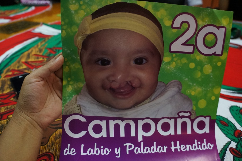 2A CAMPAÑA DE LABIO Y PALADAR HENDIDO