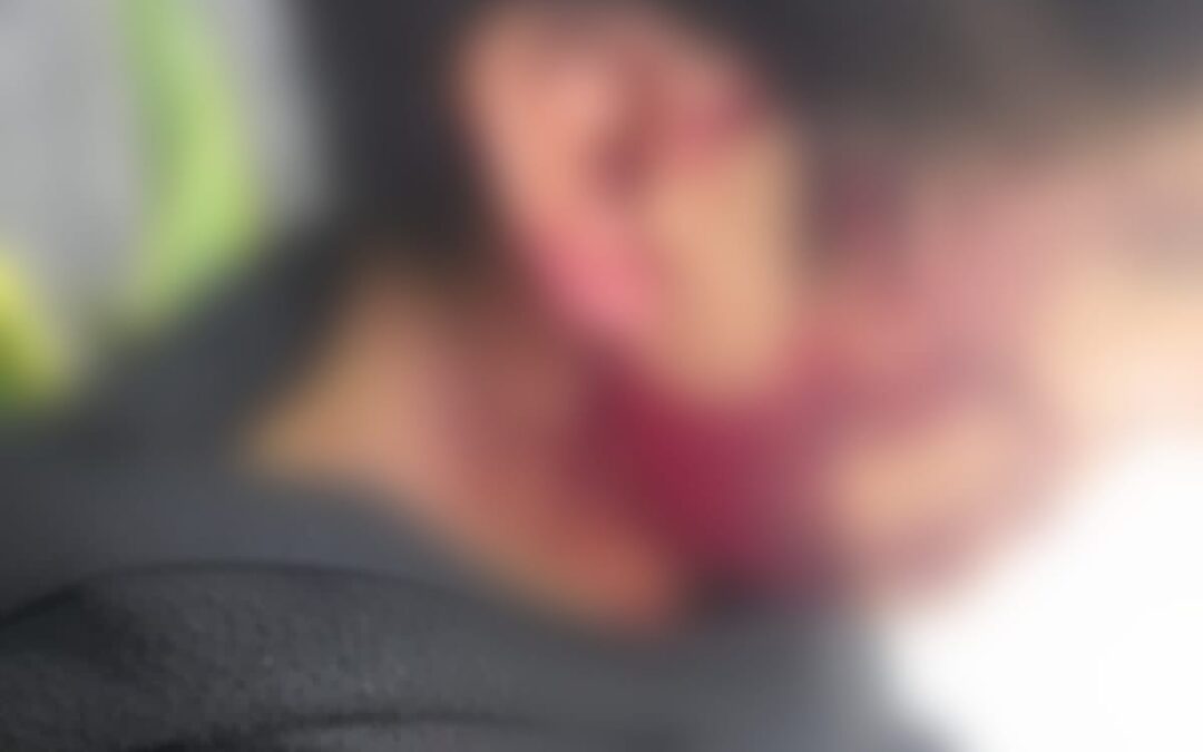 ITERVINO EN RIÑA Y RESULTÓ CON HERIDA EN OREJA