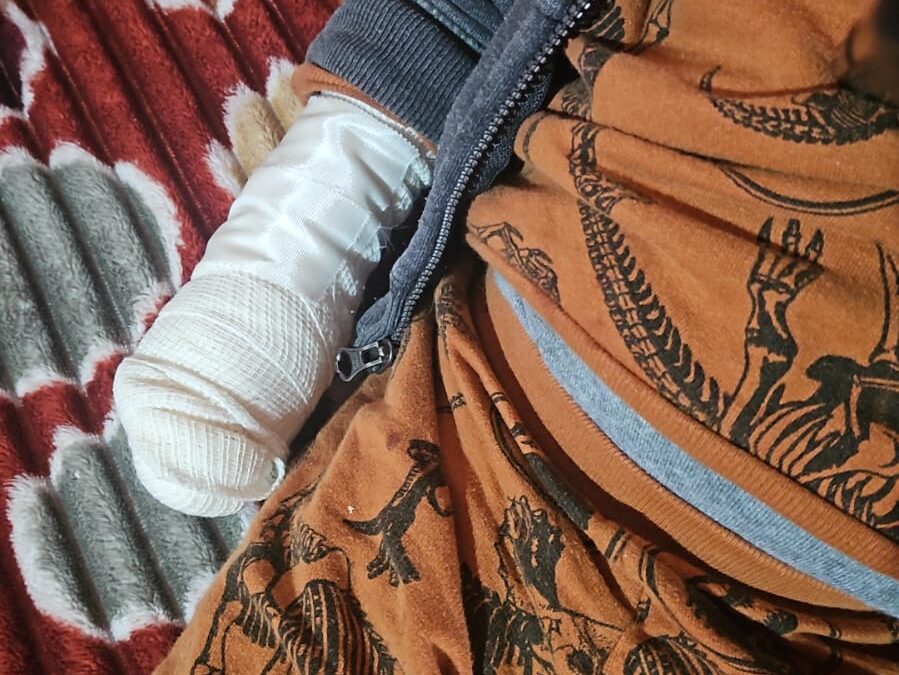 MENOR SE CORTA DEDOS POR VIDRIO QUEBRADO EN  VITRINA DE UN NEGOCIO